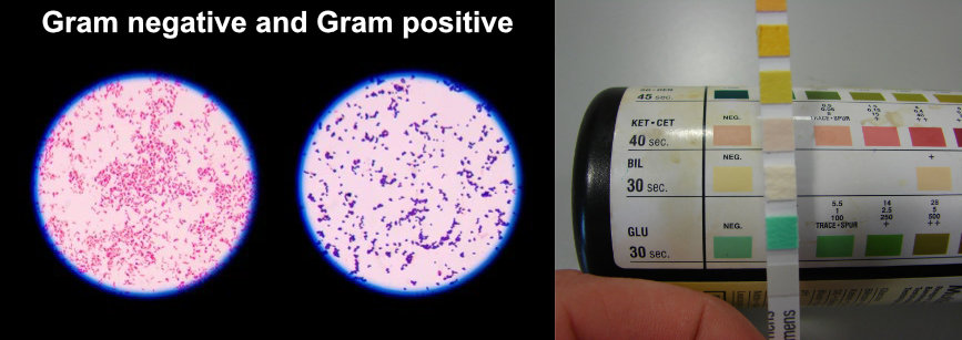 Microscope slide comparing Gram negative and Gram positive bacteria, and a colour chart for testing urine samples